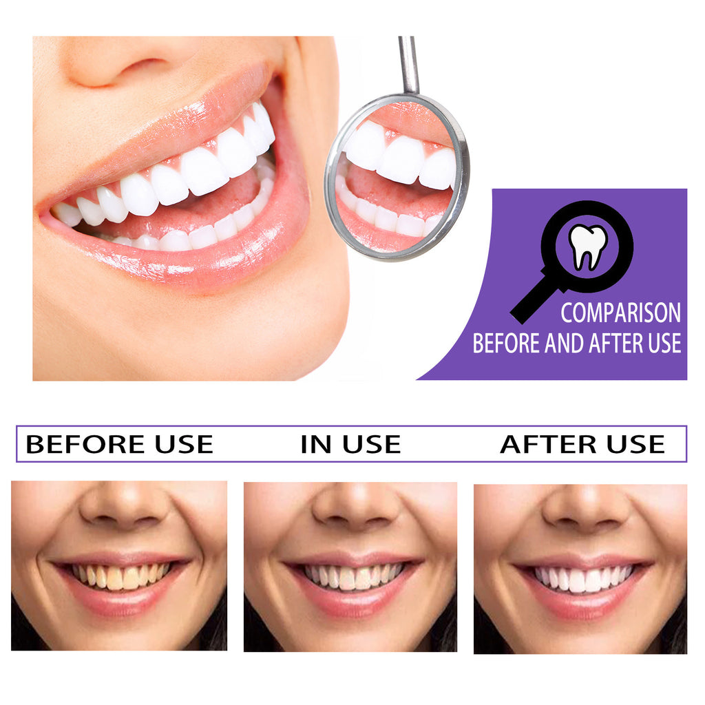 Teeth Whitening Toothpaste – Brightening Formula & Stain Removal